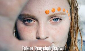 Faktor Penyebab Jerawat